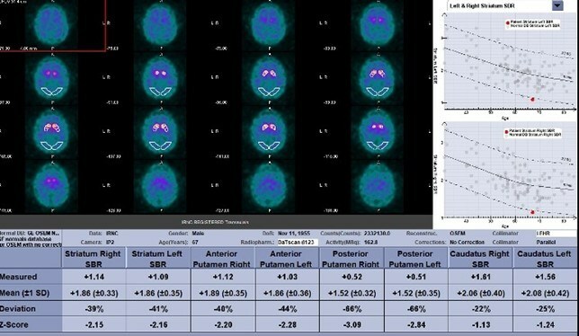 Unable to view the image, Please provide a valid URL.