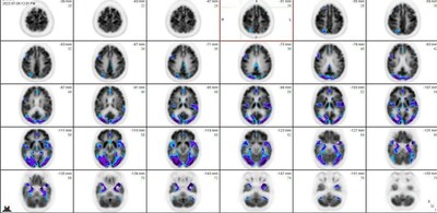 Unable to view the image, Please provide a valid URL.