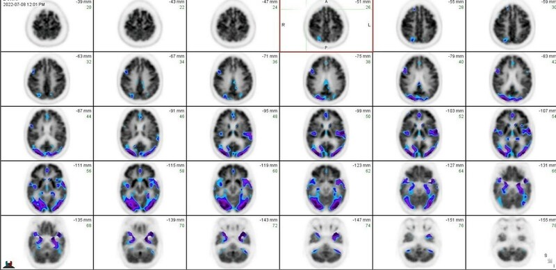 Unable to view the image, Please provide a valid URL.