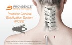 Providence Medical Technology Announces Completion of Enrollment in the FUSE Clinical Study for High-Risk Cervical Fusion Patients