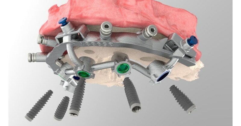 Patently the best dental surgical guide on the market - Vimarsana News