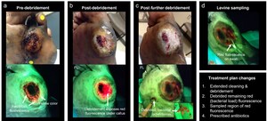Largest Published Real-World Wound Imaging Study Reports MolecuLight® led to Wound Treatment Plan Changes in up to 53% Cases