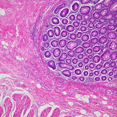 HE-stained image of human histopathological tissue acquired using the ECLIPSE Ni-L and Digital Sight 10 microscope digital camera.