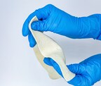 ALLOSOURCE LAUNCHES ALLOMEND DUO ACELLULAR DERMAL MATRIX, A NATURAL SOLUTION FOR NON-DIRECTIONAL IMPLANTATION IN SOFT TISSUE RECONSTRUCTION