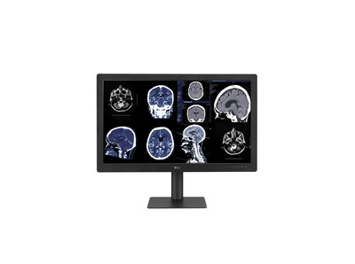 The new LG 31.5-inch IPS Black diagnostic monitor features an 8-megapixel resolution and a 2,000: 1 contrast ration to deliver the clarity needed for medical imaging. (CNW Group/LG Electronics Canada)