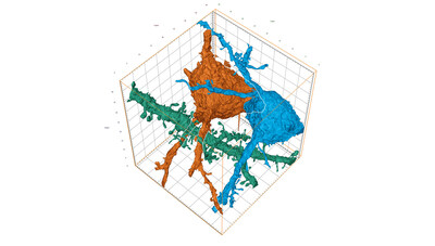 3D reconstruction of mouse brain neurons. Sample courtesy of Christel Genoud, Université de Lausanne, Switzerland