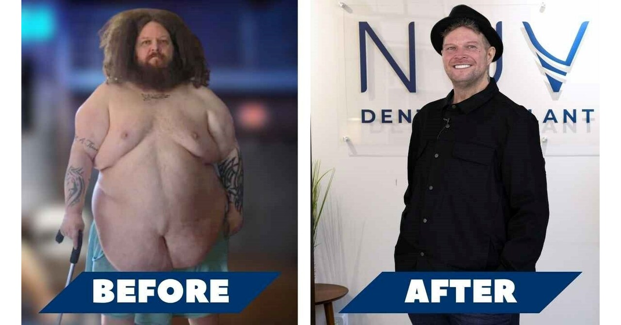 Inspiring Transformation: Man Loses 300 lbs With DDP Yoga, Gets Awarded  Smile Makeover From Nuvia Dental Implant Center