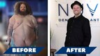 Inspiring Transformation: Man Loses 300 lbs With DDP Yoga, Gets Awarded Smile Makeover From Nuvia Dental Implant Center