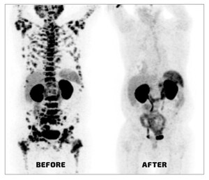 Serva Energy Discovers Promising New Way to Produce Cancer-killing Actinium-225 Isotope