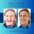 NUVIA Dental Implant Center Expands Services with New Location in Tampa, Florida