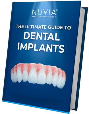 The Ultimate Guide to Dental Implants Book Cover