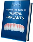 Unlock the Secrets of Full Mouth Dental Implants with the Ultimate Guide