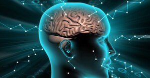 AMA issues CPT III code for icometrix' AI-related brain MRI quantification software