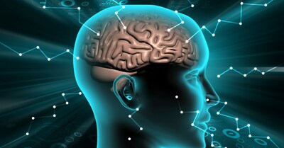La Asociación Médica Americana (AMA) ha concedido a icometrix un nuevo código CPT Categoría III para nuestro software de análisis cuantitativo de resonancia magnética cerebral.