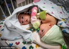 Texas Children's Hospital Announces Homecoming for Formerly Conjoined Twin Girls Ella Grace and Eliza Faith Fuller