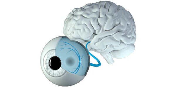 Optina's Landmark REPHRASE Study to Validate an Innovative Cerebral Amyloid Status Test for the Diagnosis and Management of Alzheimer's Disease - Vimarsana News