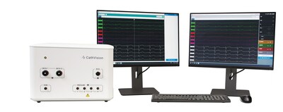 Through the acquisition of high-fidelity, low-noise EP signals, the ECGenius™ System provides a distinct advantage in signal quality to help physicians identify, diagnose, and treat complex cardiac arrhythmias.