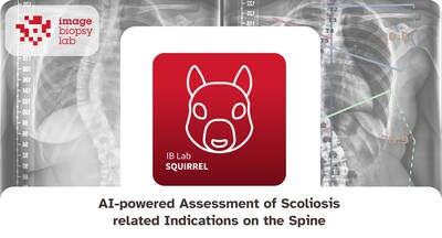 AI-powered Assessment of Scoliosis related Indications on the Spine