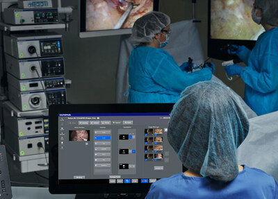 The EASYSUITE™ ES-IP system is Olympus' newest procedure room visualization and integration solution