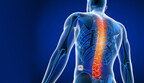 Soin Neuroscience Tests Very Low Frequency Spinal Cord Stimulation in Humans