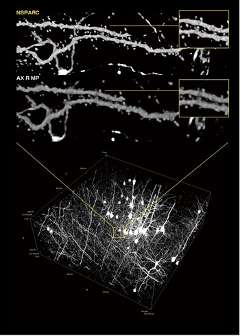 Upper: acquired using AX R MP with NSPARC, middle and lower: acquired using AX R MP. Image of deep part of mouse neuron with optical tissue clearing (within yellow frames: identifying the shape and size of a spine neck can be expected to contribute to the clarification of neural activity). Sample courtesy of: Lin Daniel, PhD., SunJin Lab Co.