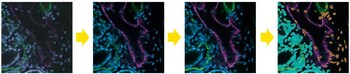 Workflow for image processing using AI functions. From left to right: Original, Autosignal.ai (Automatically identify optimal excitation laser intensity and gain), Denoise.ai (Automatically remove noise from images), Segment.ai (Automatically detect objects for counting and morphology analysis).