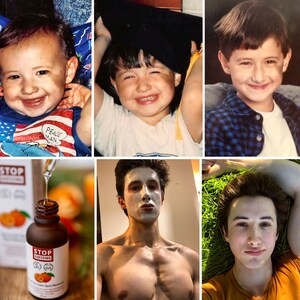 From Childhood Scar to Skincare Stardom: Entrepreneur Transforms Pain into Profitable Success with BioFormula Select's Brand Stop Guessing Skincare