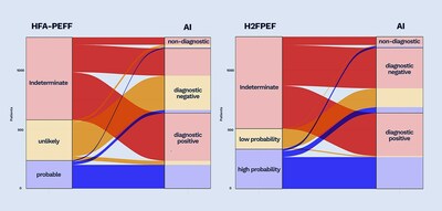 AI had fewer non-diagnostic outputs compared to HFA-PEFF and H2FPEF, correctly reclassifying 515 (73.5%) of patients and 571 (73.6%) of patients, respectively. (PRNewsfoto/Ultromics)