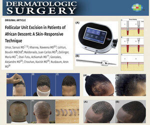 التقنية الثورية تقدم الأمل في استعادة الشعر لدى الأفراد المنحدرين من أصل أفريقي