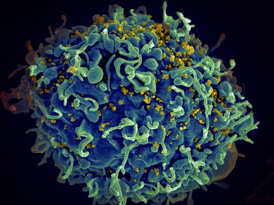 HIV virus (yellow) infecting a human cell © Photo by National Cancer Institute on Unsplash