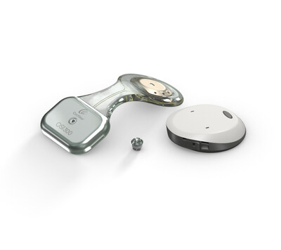 Osia Sound Processor and OSI300 Implant