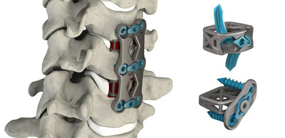 4WEB Medical Cervical Portfolio