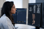 SECTRA SIGNS ENTERPRISE IMAGING CONTRACT WITH ONE OF THE LARGER MULTI-REGION HEALTHCARE SYSTEMS IN THE US