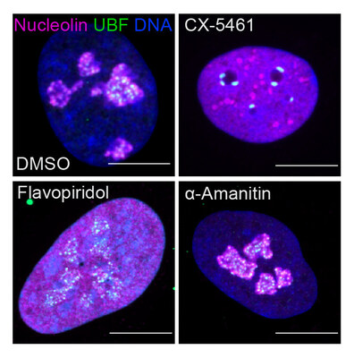 Fluorescent images showing nucleolar stress induced by drugs that inhibit transcriptional enzymes, or cyclin-dependent kinases (CDK). The upper left panel shows a normal cell with two important nucleolar proteins stained (magenta and green) and DNA (blue). The remaining panels show the impact of CDK or transcription inhibitory drugs on nucleoli. Image courtesy of Tamara Potapova, Gerton Lab, Stowers Institute for Medical Research.