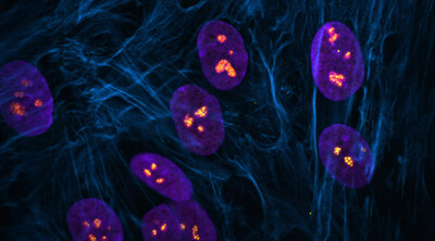 Fluorescent image showing cells with normal nucleoli (bright orange) in nuclei (purple) surrounded by actin filaments (dark blue). Image courtesy of Tamara Potapova, Gerton Lab, Stowers Institute for Medical Research.