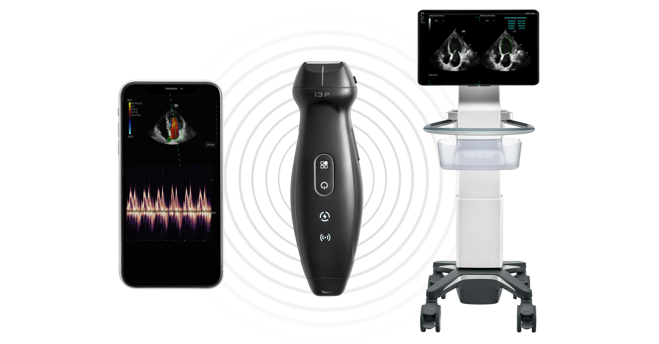 Mindray updates TE Air wireless probe for standalone POCUS