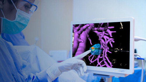 Techsomed - VisAble.IO 3D Ablation Assessment view