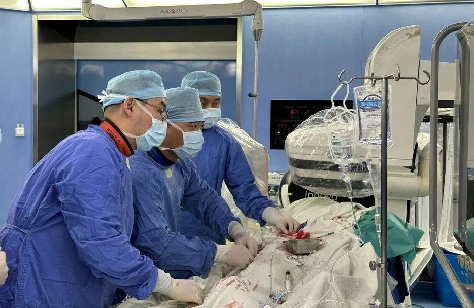 First Patient with NyokAssist™ Interventional Ventricular Assist Device: Dr. Junbo Ge's team successfully completed the first high-risk PCI treatment supported by the new generation of interventional VAD - Vimarsana News