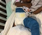 Lawsuit: Overcrowding Responsible for 1-Year-Old's Broken Leg at God's Little Tikes Childcare