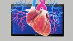 Groundbreaking 3D Monitor Developed for Medical, Engineering, Design and Gaming