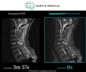 Subtle Medical Awarded $2.3M SBIR Grant to Expand Innovation in AI-powered Synthetic Imaging