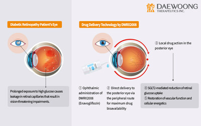 Daewoong Therapeutics Gets MFDS Nod for Phase 1 IND for the World's First Eyedrop Treatment for Diabetic Retinopathy and Macular Edema