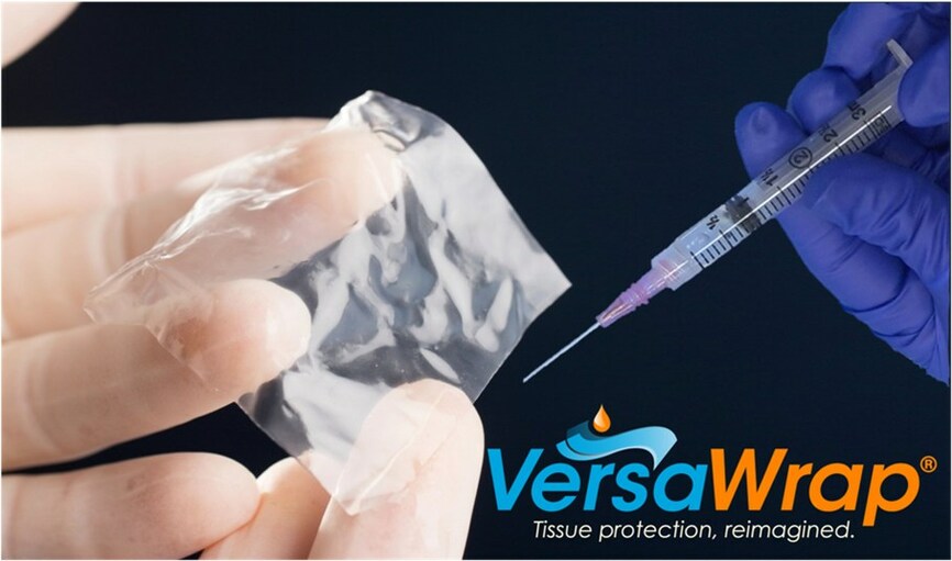 Alafair Biosciences Receives Innovative Technology Contract from Vizient for VersaWrap® - Vimarsana News