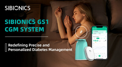 SIBIONICS CGM