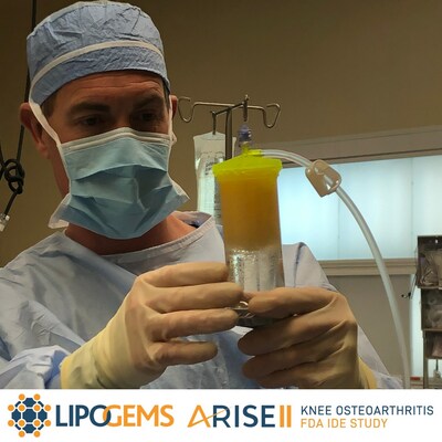 Dr. Brandon Broome, orthopaedic surgeon, performs Lipogems procedure