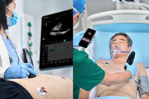 Mindray to Reveal First of its Kind Wireless Handheld Ultrasound System Live at ACEP23 Scientific Assembly