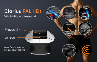 The new Clarius PAL HD3 is a wireless handheld whole-body ultrasound scanner combining phased and linear arrays on a single head. This device offers exceptional image quality and versatility for real-time imaging of both superficial and deep anatomy at the bedside , making it suitable for a wide range of clinical applications while improving workflow continuity. (PRNewsfoto/Clarius Mobile Health)