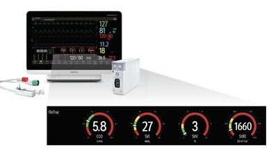 Mindray’s BeneVision N-Series is the first patient monitoring platform to integrate Edwards’ FloTracTM sensor technology to offer greater insights into advanced hemodynamic monitoring to manage patients’ perfusion and guide individualized treatment decisions effectively.