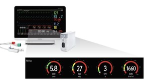 Mindray's Collaboration with Edwards Lifesciences Marks the First Integration of The FloTrac™ Sensor for Multiparameter Bedside Monitoring