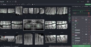 DENTI.AI PIONEERS FDA-CLEARED PATHOLOGY DETECTION IN BOTH PANORAMIC AND INTRAORAL X-RAYS WITH LAUNCH OF DENTI.AI DETECT